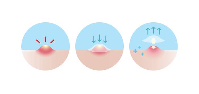 how acne patches work