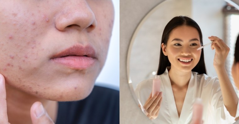 layering skincare ingredients